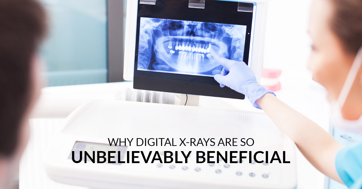 digital-58c2e1ecccaa9