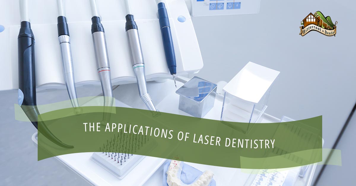 BlogBeauty-Bitterroot-TemplateThe-Applications-Of-Laser-Dentistry-59d523159fe20