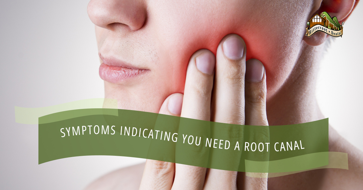 Symptoms-Indicating-You-Need-A-Root-Canal-59fb2d59b7477