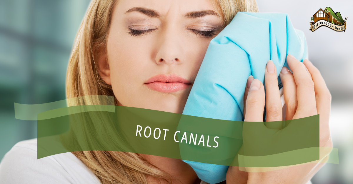 Root-Canals-5af49f54ae0c1