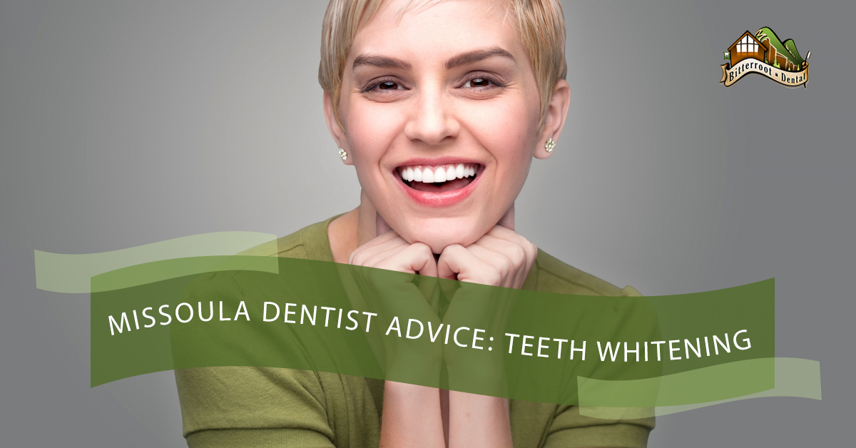 Missoula-Dentist-Advice-Teeth-Whitening-5b8efd41c2359