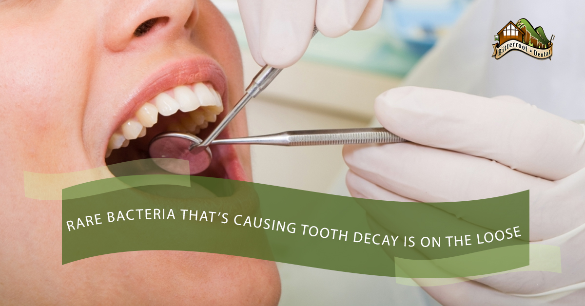 Rare-Bacteria-Thats-Causing-Tooth-Decay-Is-On-The-Loose-5b8efd66daead