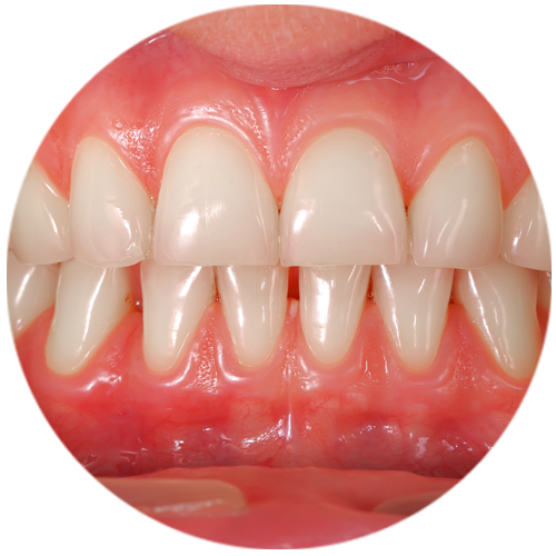 Big-Circles-5d13a45190bab