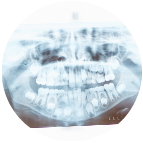 Big-Circles-5d13b143805a8